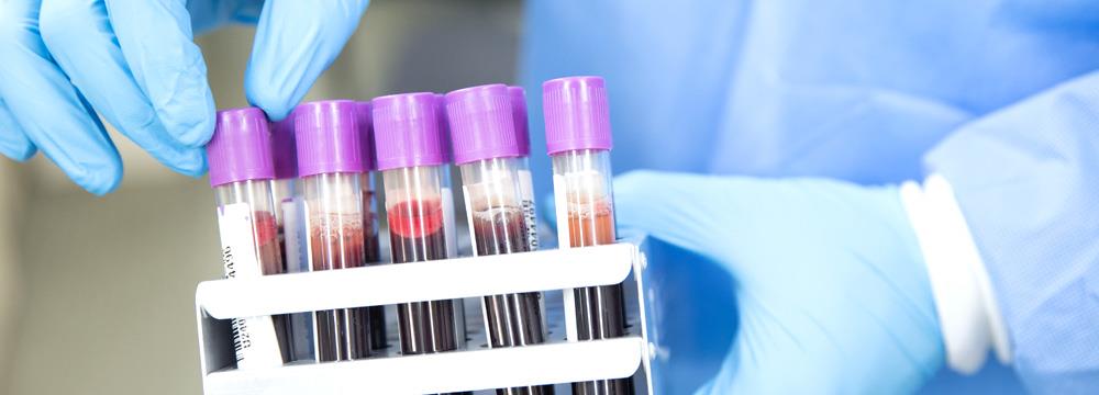 Kedi Ve Kopeklerde Kan Gruplari Ve Kan Nakli Limavet Avcilar